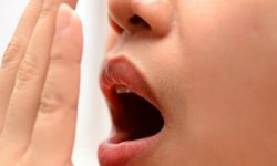 Экстренные меры: как вывести запах лука изо рта за несколько минут